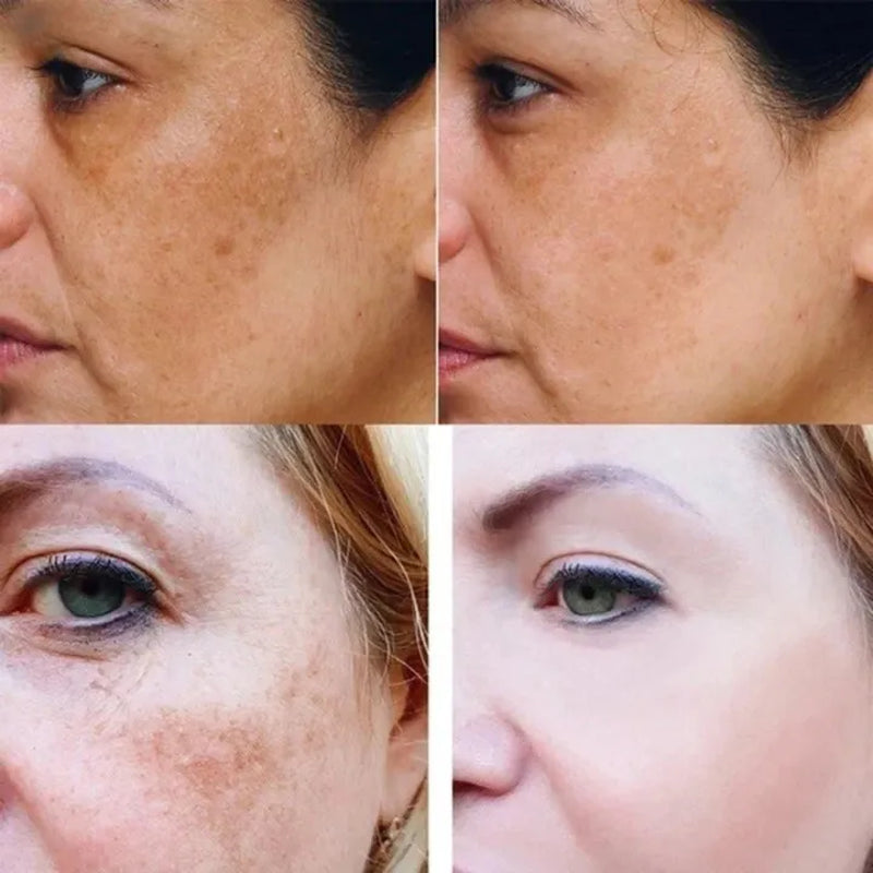 Turmeric Dark Spot Correcting Serum – Brightening & Whitening 
